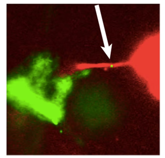 Fluorescence microscopy showing neuronal mitochondria in green transferred into tumor cells in red
